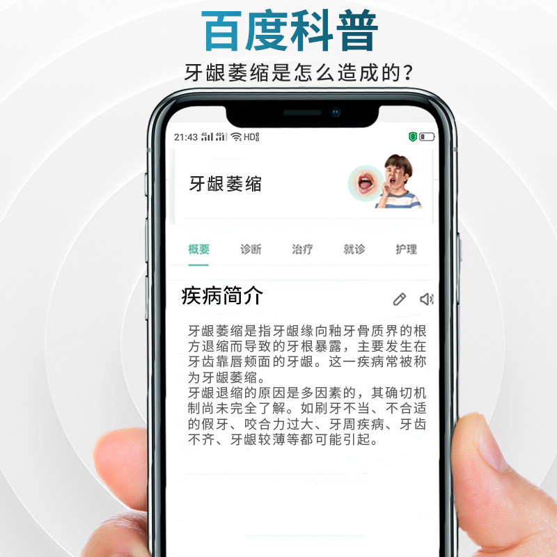 牙周炎牙齿松动牙龈萎缩修复cw牙膏 肯芙洛牙齿脱敏剂