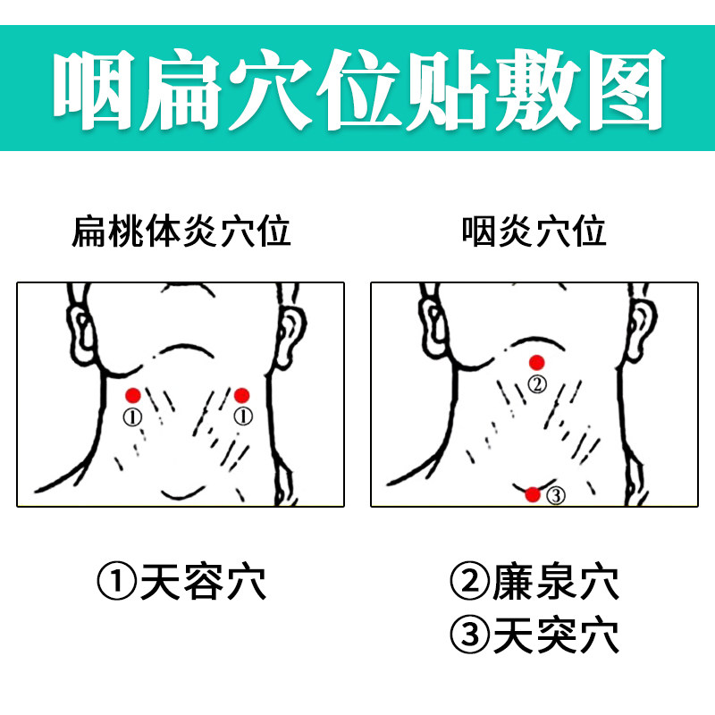 肯芙洛膏药贴（器械）