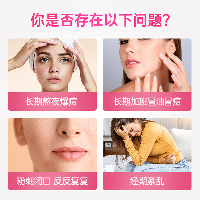 nutrition29海外旗舰店澳洲N29纽西臣祛痘片维生素b族月见草 维生素b6 软油胶囊内分泌vb0