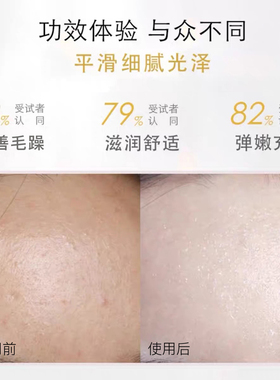 hopedense去闭口任何肌肤精华液