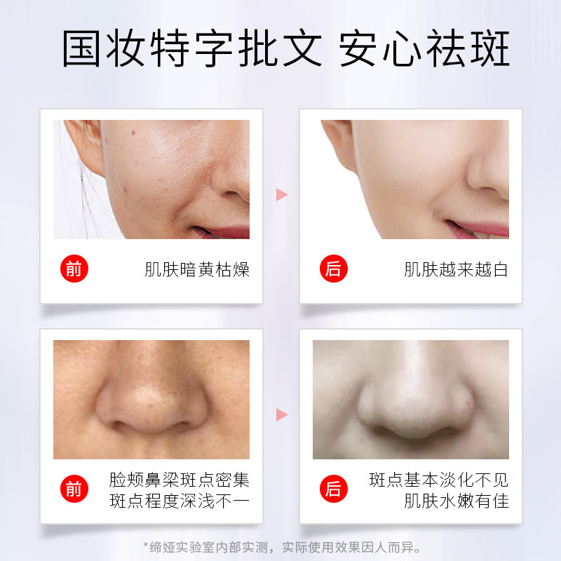 缔娅琪钰美白雀斑去黑色素祛斑霜 缔娅乳液/面霜