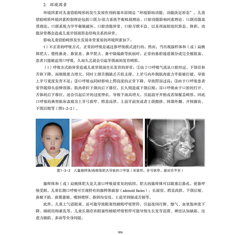精装正版现货 中国儿童错颌畸形早期矫治专家共识及病例解析+当代儿童正畸矫治经典应用 口腔专业医学书籍 组合 李小兵著 华西口腔