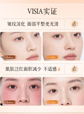 OPOSI维生素C水乳套装保湿补水秋冬熬夜改善暗沉正品官方旗舰店