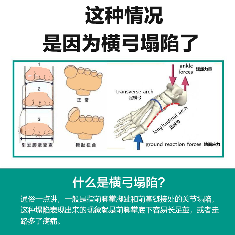 横弓塌陷矫正鞋垫脚掌疼痛垫前脚掌垫防痛垫男女前足弓支撑横弓垫 - 图1