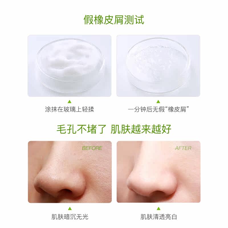 希卡贝尔去角质慕斯面部女清洁毛孔 希卡贝尔面部磨砂/去角质