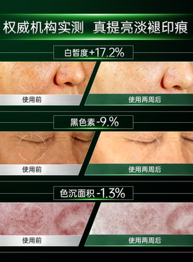 【双11狂欢】欧玛美版杜克色修精华液祛痘舒缓淡化痘印效期至28.1