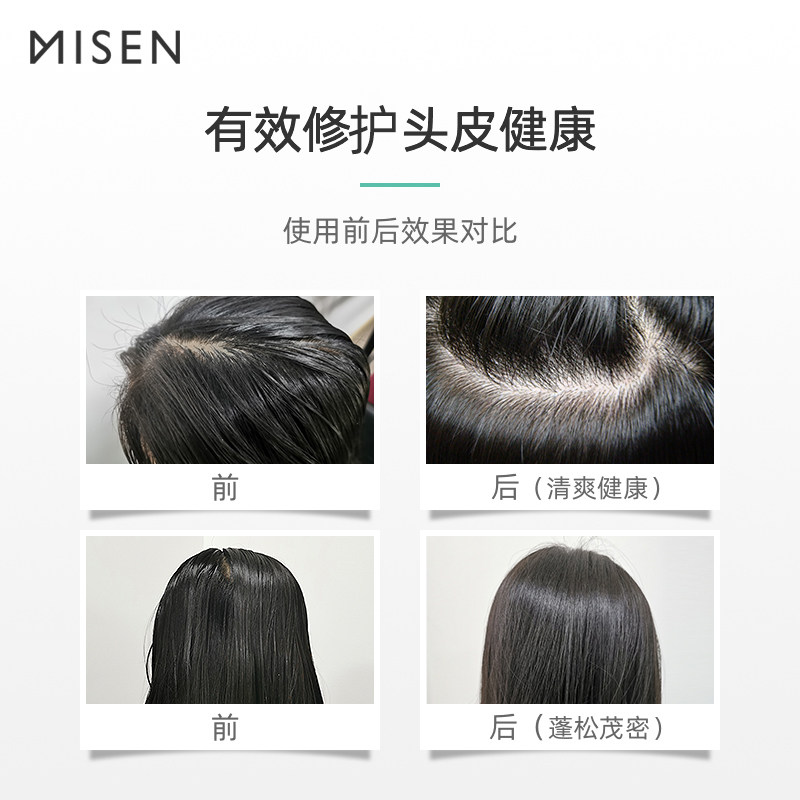 密森清爽控油洗护套装去油护发素 密森化妆品洗护套装