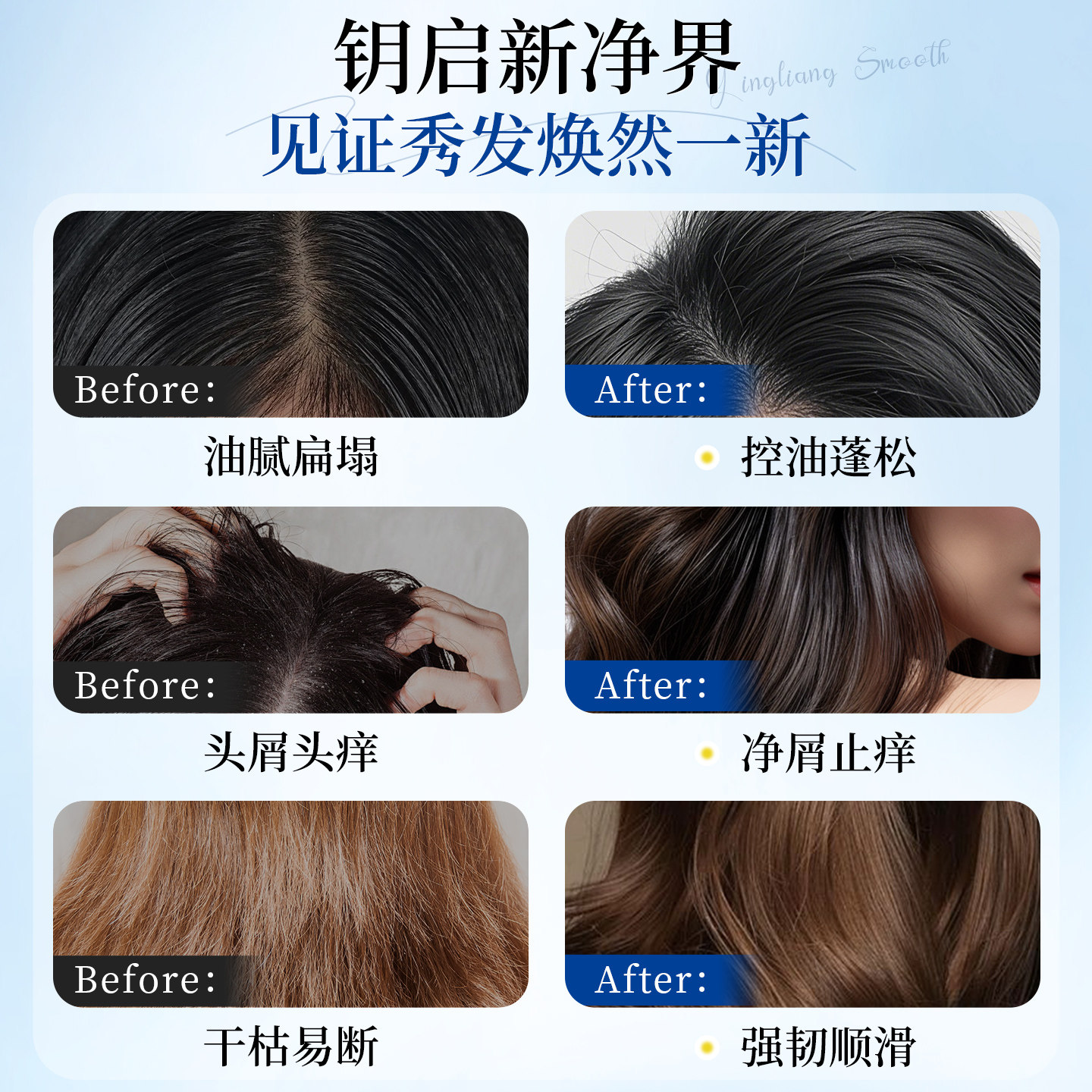 阿黛尔去油洗发水控油蓬松去屑止痒男女士精油润发洗发露正品品牌