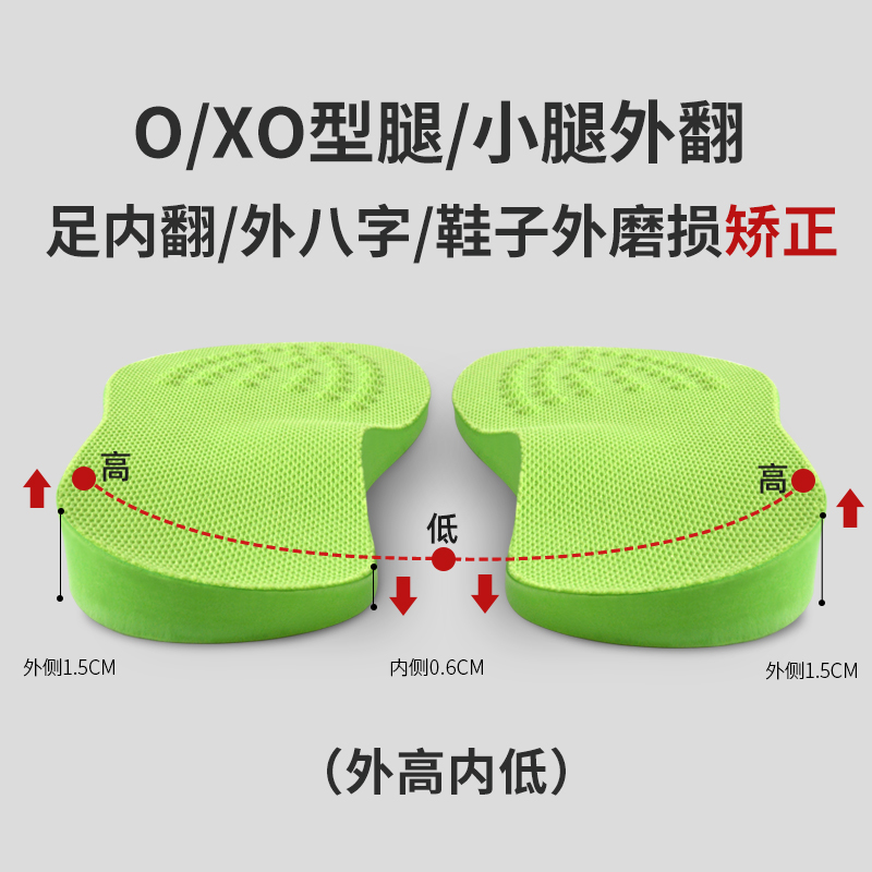 日本xo型腿足外翻纠正小腿外翻内八字脚矫正鞋垫改善腿型神器成人 - 图2