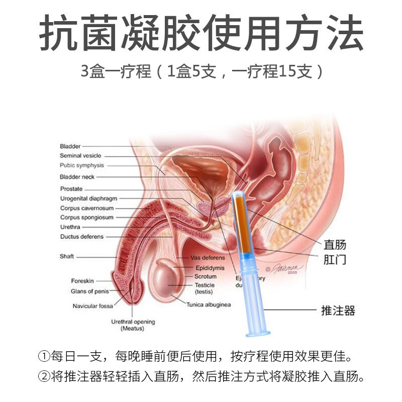 正品邦列安凝胶治疗男科慢性尿频贴 思予医疗器械保健理疗
