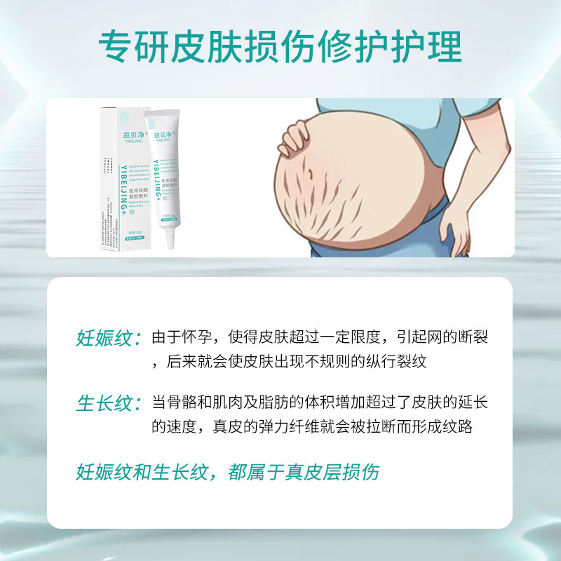 yibeijing益贝净肥胖纹生长纹 益贝净祛疤产品