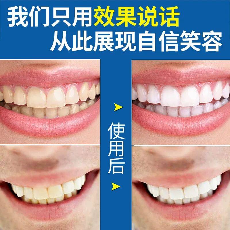美目盼兮美白牙贴美白 舒奈美小禾诗蔓牙齿美白仪