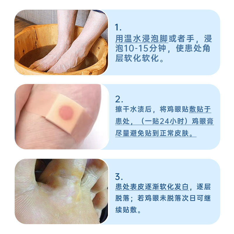 南京同仁堂鸡眼贴鸡贴眼膏鸡跖疣瘊子脚底去老茧尤平康净扁平疣-图2