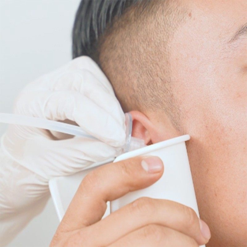 冲洗耳朵耳盆接水盆吸水球医用洗耳采耳球店家庭个人采耳专用工具,淘宝优惠券,粉丝福利购,淘宝优惠卷