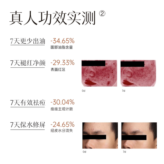 Beruhigende, reparierende, feuchtigkeitsspendende und gesunde Ölkontrollessenz