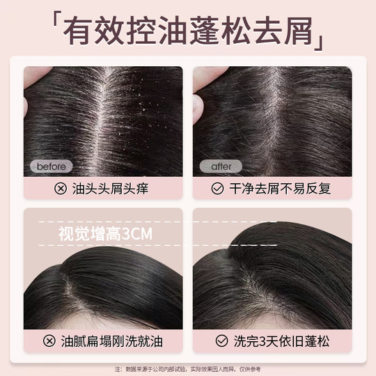 Oil-controlling fluffy fragrance shampoo, anti-dandruff and anti-itching