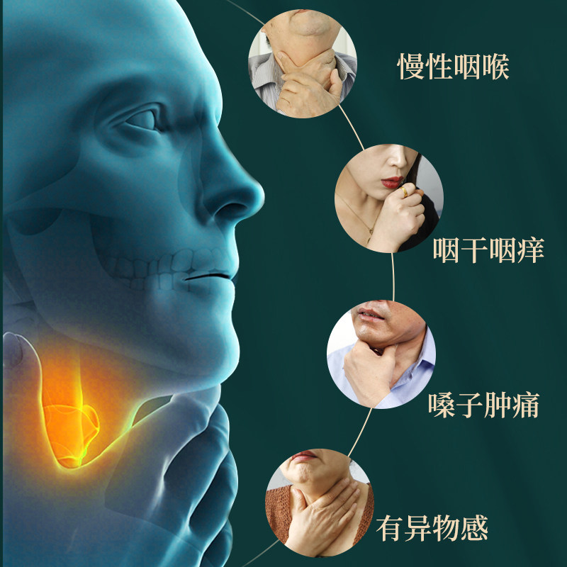 咽扁舒软膏李时珍芙顺堂咽喉炎药膏 小禾诗蔓医疗器械膏药贴（器械）