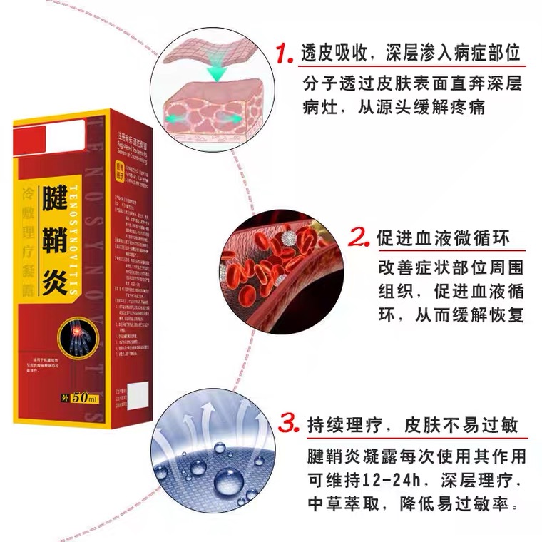 华北制药腱鞘炎喷剂医用冷敷凝胶旗舰店专用膏手指疼腱消炎膏药贴 - 图1