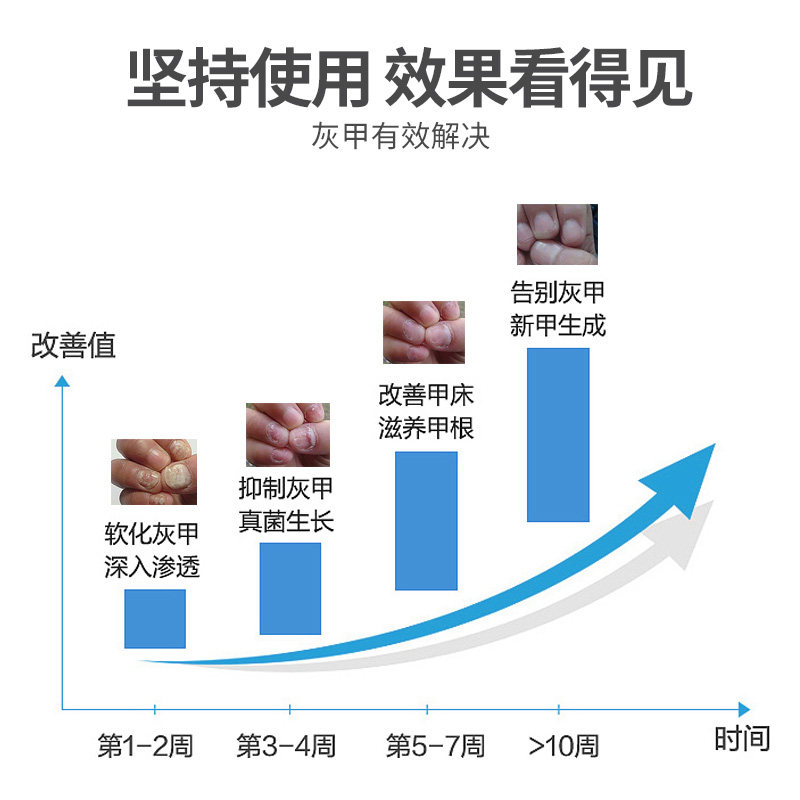 仁和康宝灰指甲治疗专用药h冰醋酸 小禾诗蔓医疗器械保健理疗
