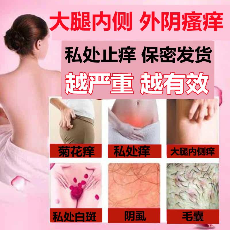 女性私处肛门下面痒外阴瘙痒止痒膏 小禾诗蔓医疗器械皮肤消毒护理（消）