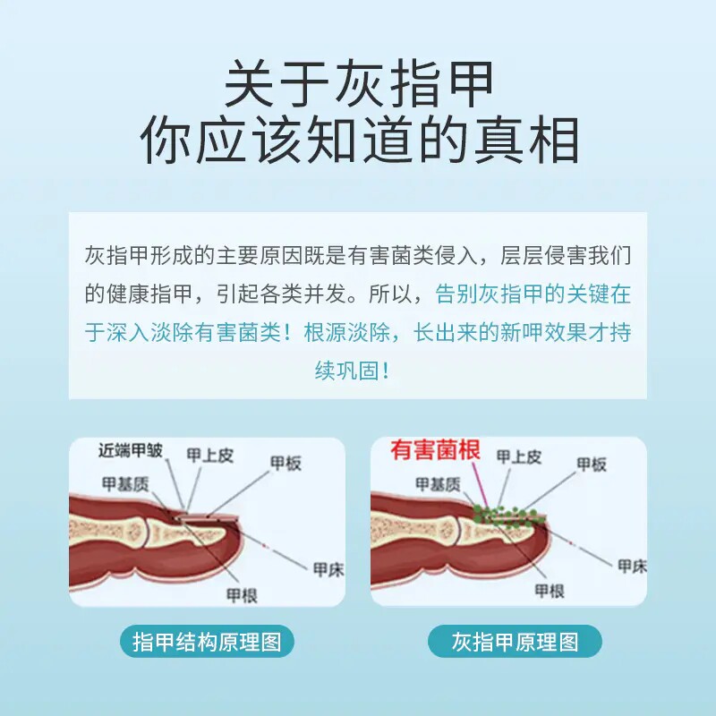 灰指甲正品官方旗舰店套装药修复液 小禾诗蔓医疗器械保健理疗