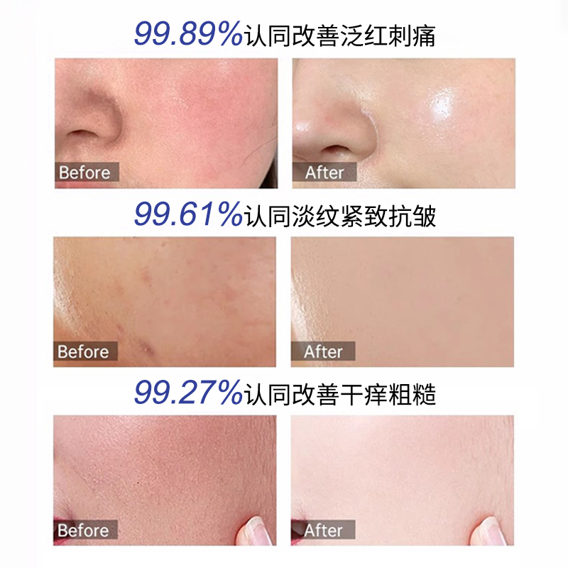 SYUMON水韵梦蓝绷带胶原蛋白多维润护面霜紧致保湿滋润补水乳液