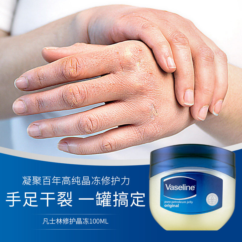 凡士林修护晶冻保湿经典套装润肤霜 WINWAY海外身体乳液