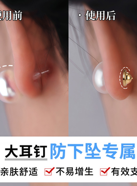 Lnieer飞碟支撑耳堵耳钉后塞防掉
