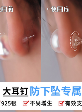 硅胶飞碟耳堵固定支撑耳帽