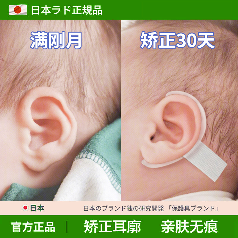 日本耳廓矫正器婴儿耳撑新生的儿宝宝耳朵定型招风耳神器硅胶耳贴