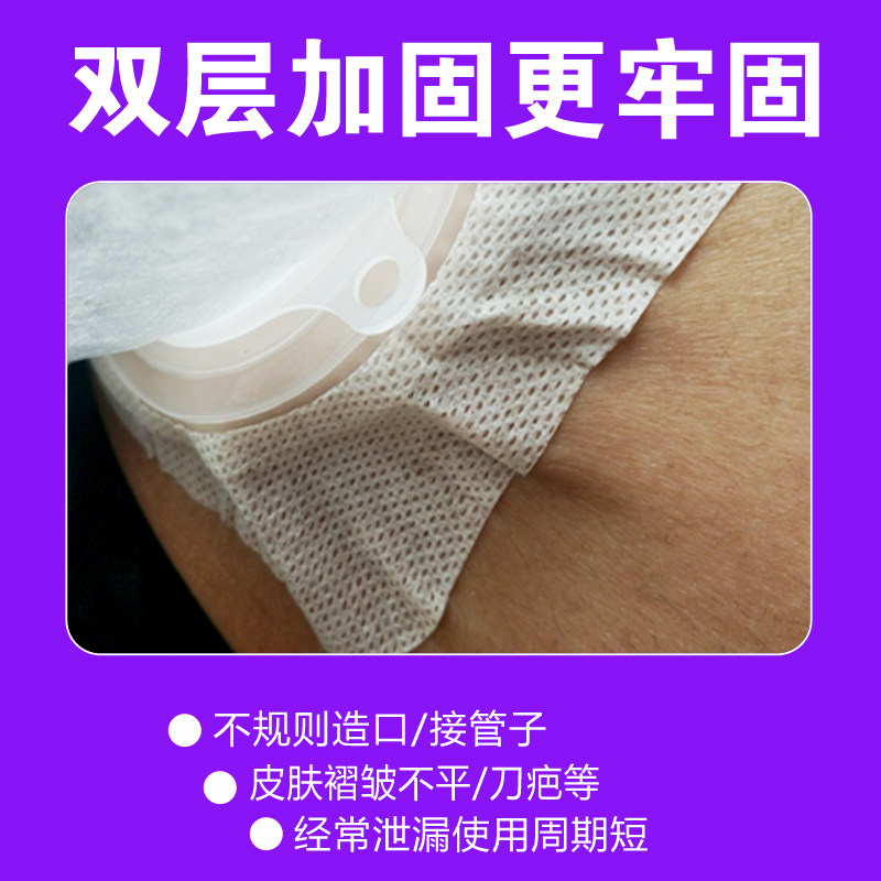 思泰利尿路造口袋粘贴式小便袋 漫森医疗器械造口袋