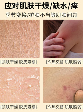 止痒身体乳保湿滋润男女士皮肤干燥全身起皮秋冬季补水肤乳同仁堂