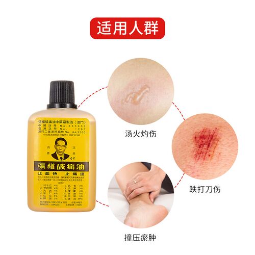 澳门张权破痛油正品 镇痛止血止痛消炎止疼油散瘀消肿 破痛油AA - 图1