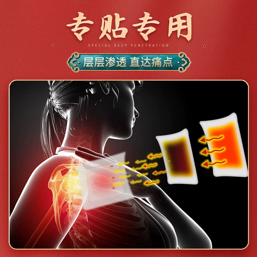 一代宗师 Шейки матки периодонтит поясничный