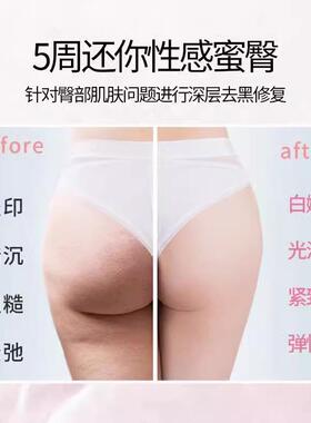 私处粉嫩屁股臀部去坐印色素水密桃臀膜pp面膜美臀霜