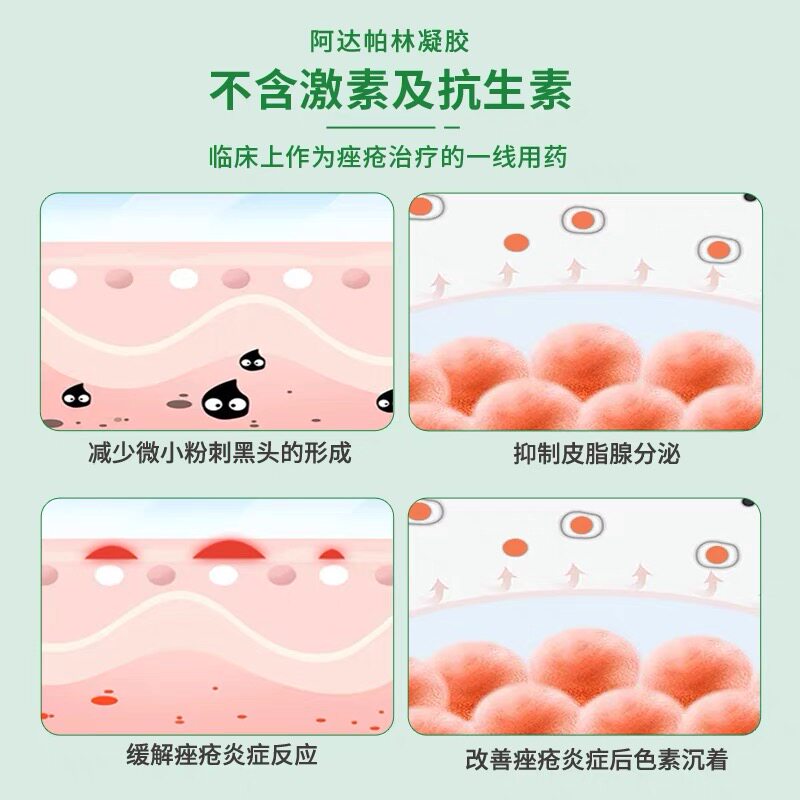 丽芙阿达帕林凝胶官方正品祛痘膏 知原皮脂汗腺