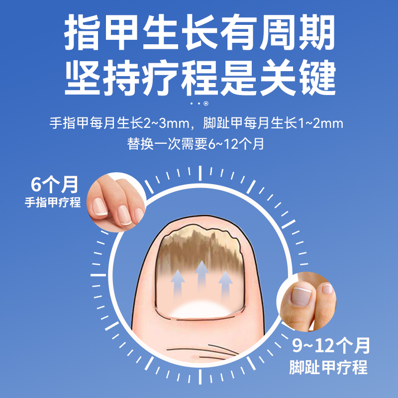 洛芙阿莫罗芬搽剂阿莫罗芬搽剂灰指甲盐酸阿莫罗芬搽剂正品旗舰店