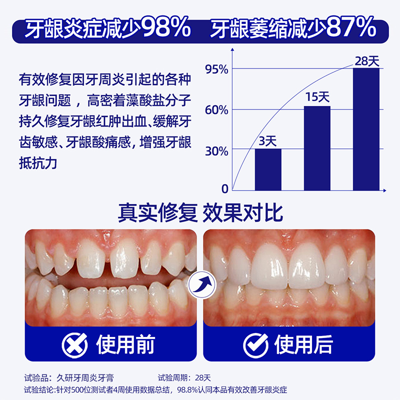 牙周炎专用牙膏治牙周炎口腔牙龈萎缩脱敏修复专用出血敏感医用L - 图0