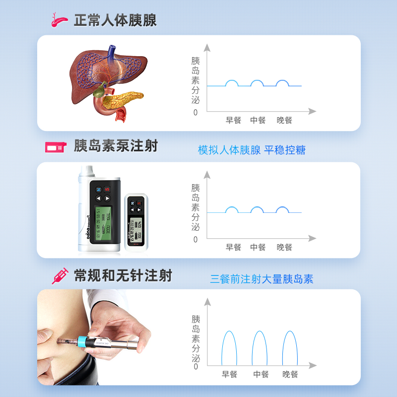 丹纳胰岛素泵DANA-Rs进口蓝牙遥控便携可闭环胰岛素泵全自动智能-图1