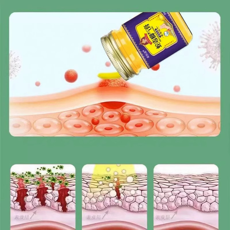  灿康保健用品皮肤消毒护理（消）