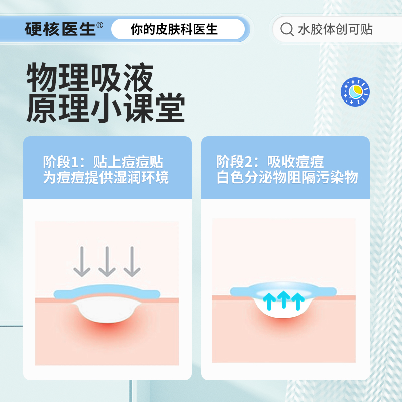 痘痘贴修复消炎痘印水胶体敷料祛净痘贴人工皮医用豆豆隐形吸脓痘-图2