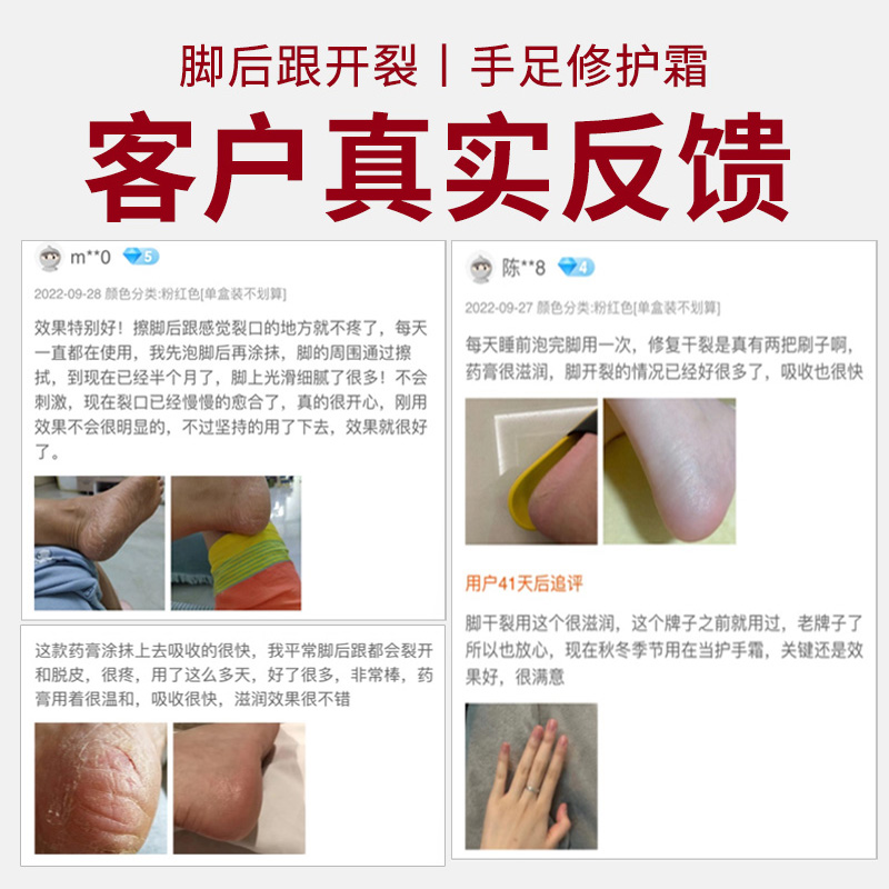 专治脚裂脚后跟干裂起硬皮足跟开裂真菌感染防皲裂脱皮修复药膏ZZ - 图3