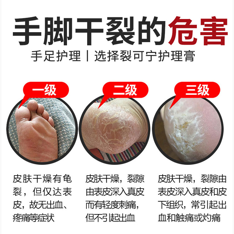 专治脚裂脚后跟干裂起硬皮足跟开裂真菌感染防皲裂脱皮修复药膏ZZ - 图2