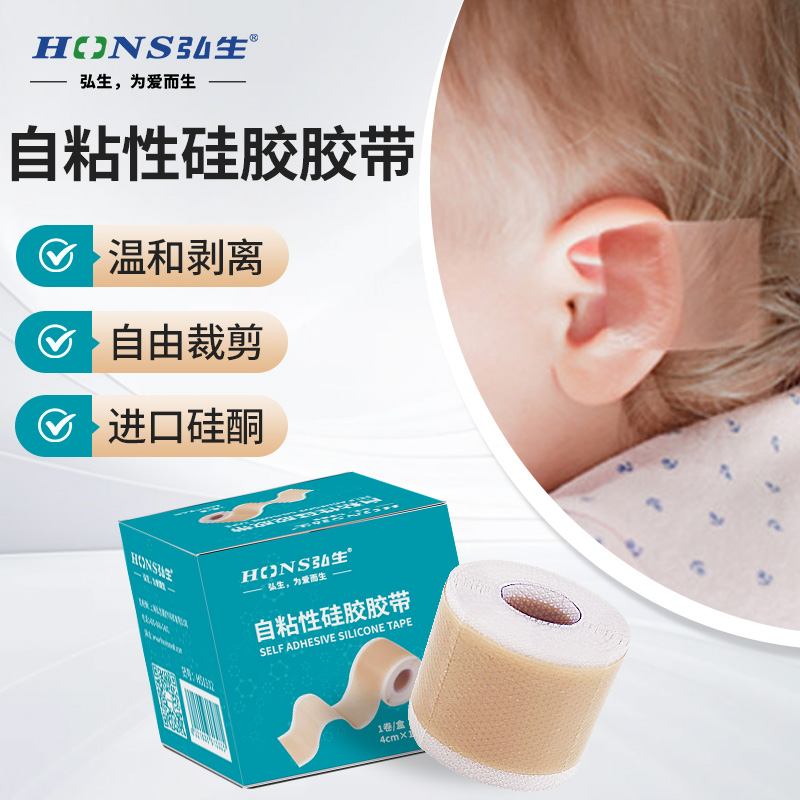 耳廓矫正贴医用硅胶胶带耳朵固定贴婴儿招风耳纠正器新生儿童宝宝