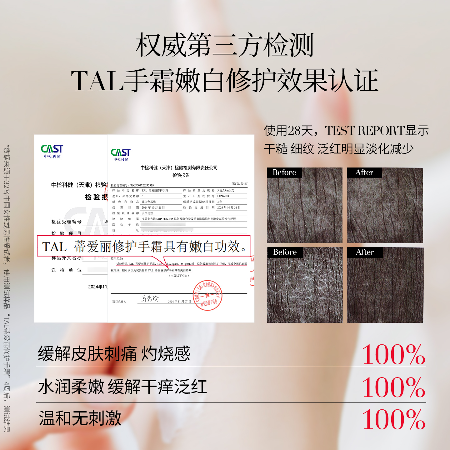 瑞士进口TAL护手霜焕白保湿嫩白去手纹手霜冬滋润手部干燥粗糙女