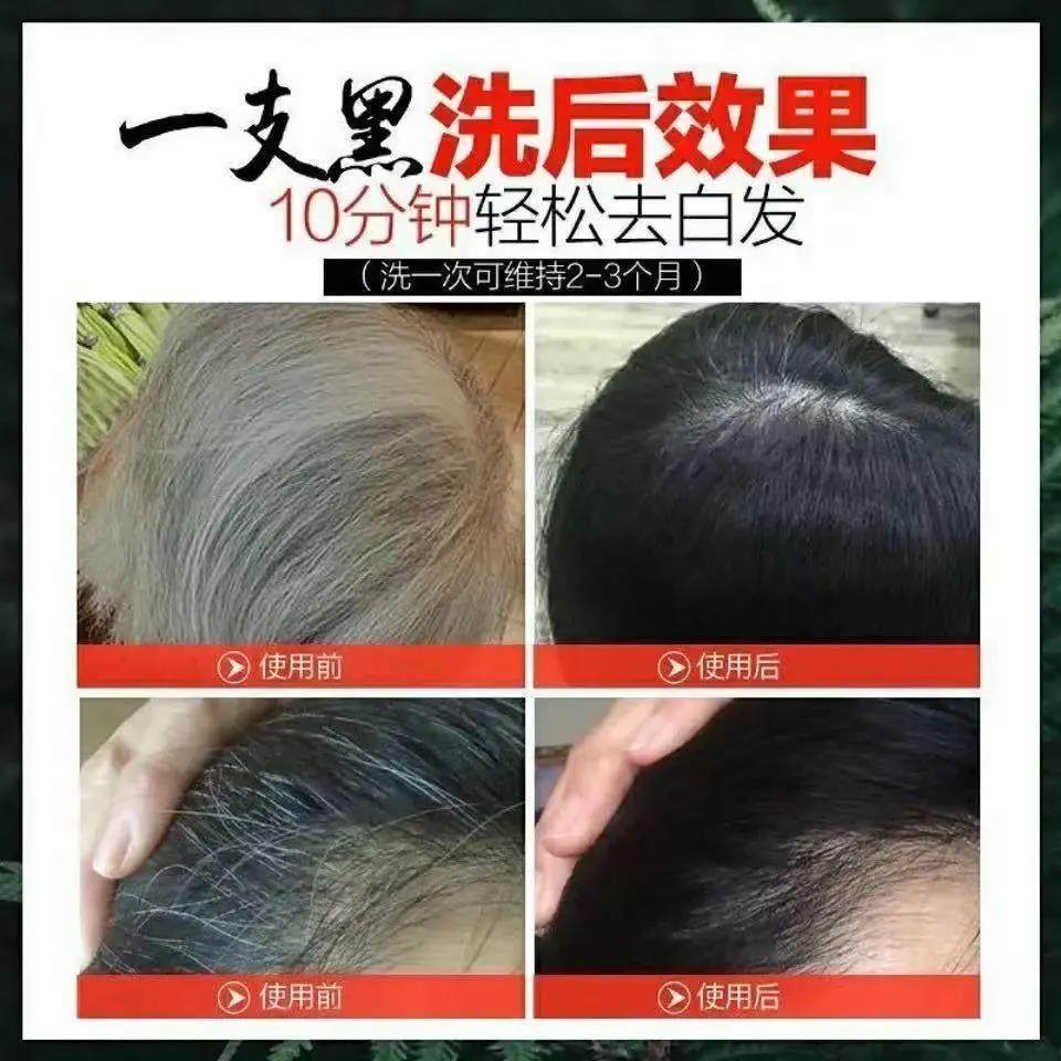 ZJ盖白染发剂一支黑泡泡天然无刺激正品品牌植物纯自己在家染发膏,淘宝优惠券,粉丝福利购,淘宝优惠卷