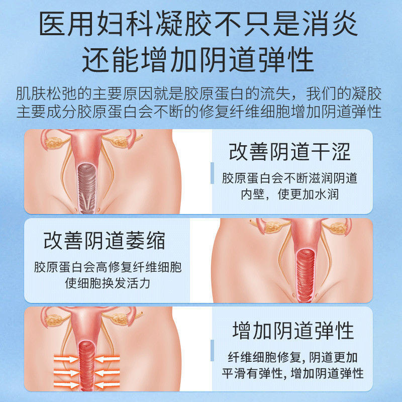 修正卡波姆炎症 增蓝医疗器械私处护理（器械）