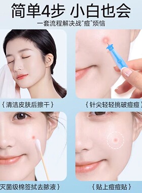 海氏海诺粉刺针一次性无菌粉刺针辐照灭菌扎破痘痘挑痘细头针30支