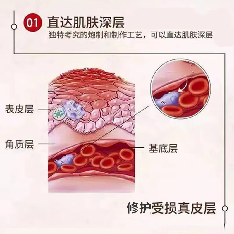 男士生殖器疱疹断药膏根疱疹净克星检测梅毒进口喷剂防复发疗OZD - 图3