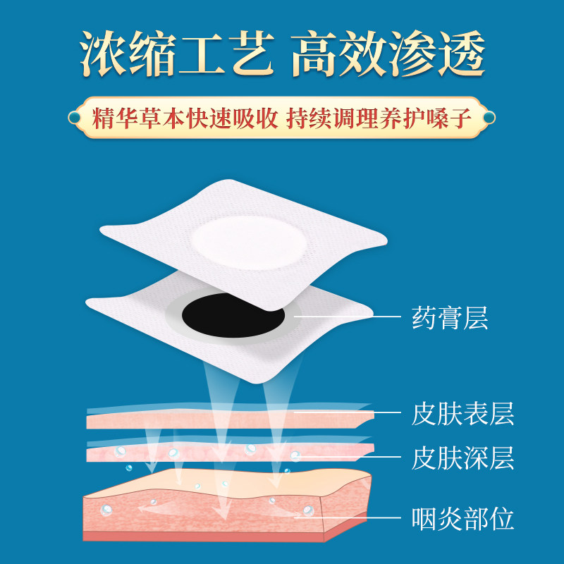 【祖医堂】咽慢性咽喉穴位贴异物感 祖医堂石家庄膏药贴（器械）